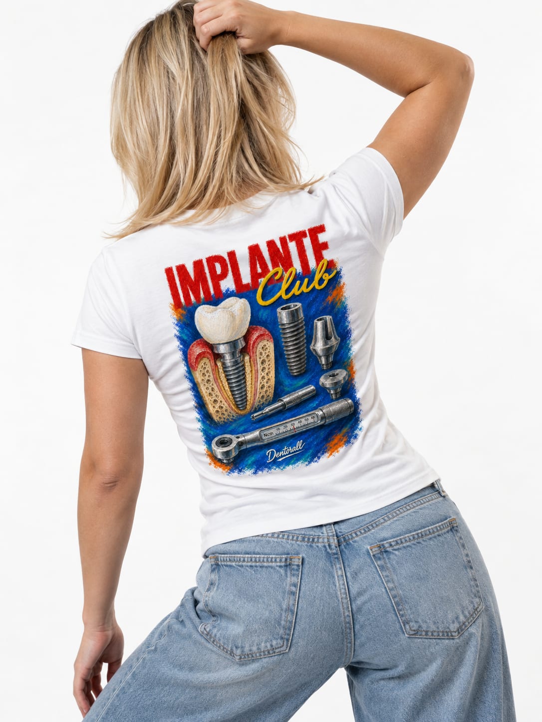 Implante Club